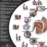All About Shoulder Pain {Infographic}
