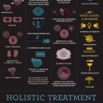 The Four Stages of Migraine (Infographic)