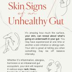 The Gut-Skin Connection | Goodness Lover