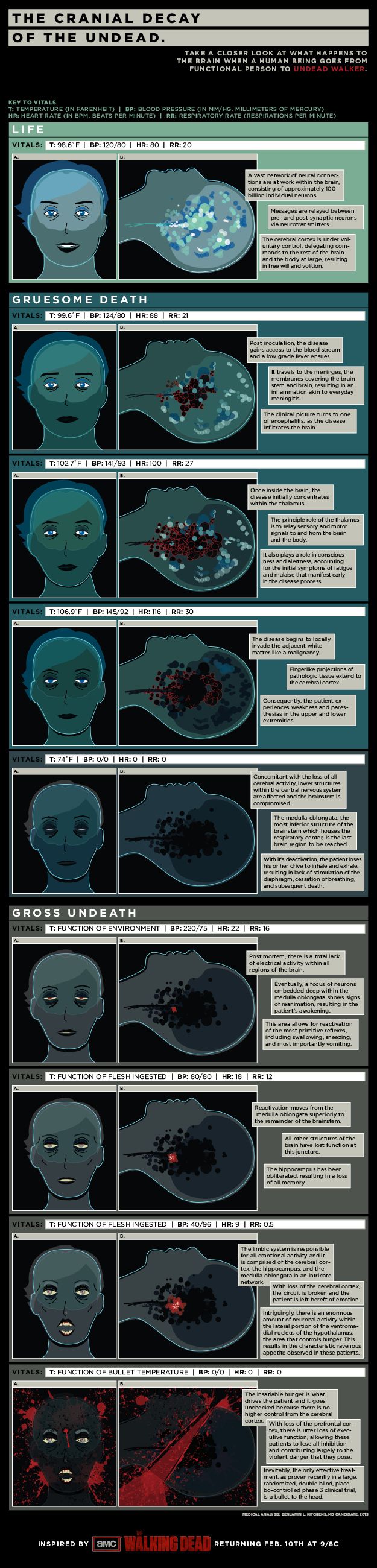 Infographic: Check Out The Anatomy Of A Zombie's Brain