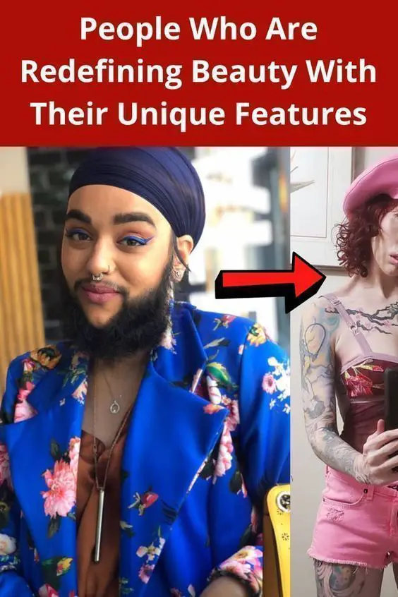 People Who Are Redefining Beauty With Their Unique Features