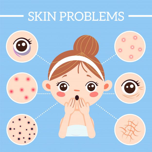 Premium Vector | Skin problems infographic