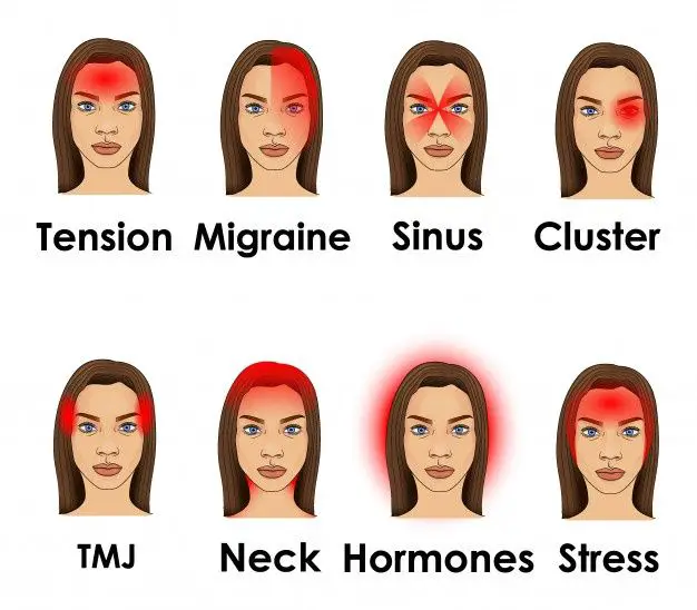 Premium Vector | Types of headache illustrated on a woman face