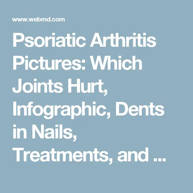 Visual Guide to Psoriatic Arthritis