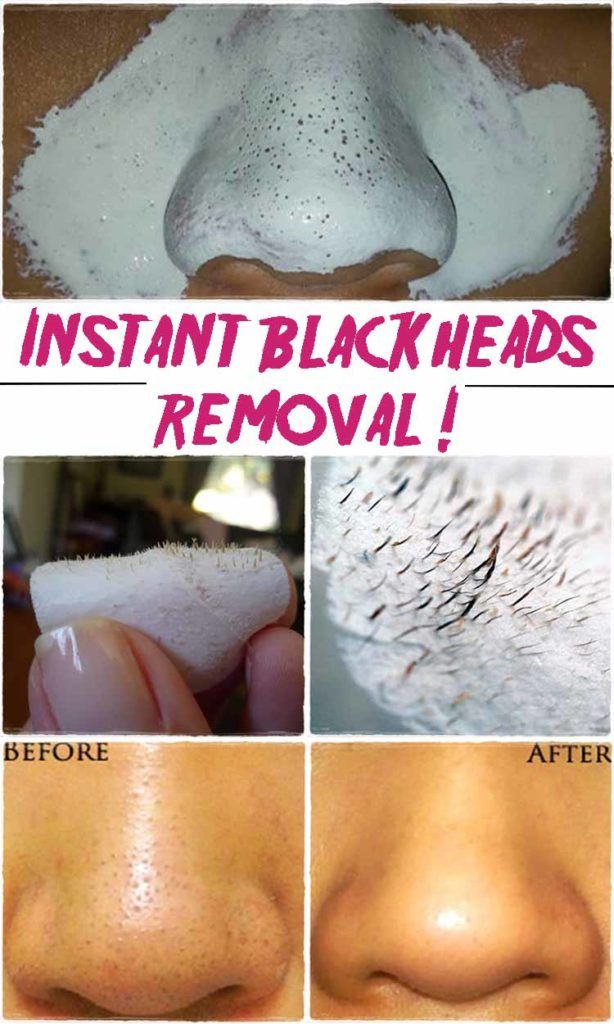 15 Amazing Beauty Hacks For Your Major Problem Areas