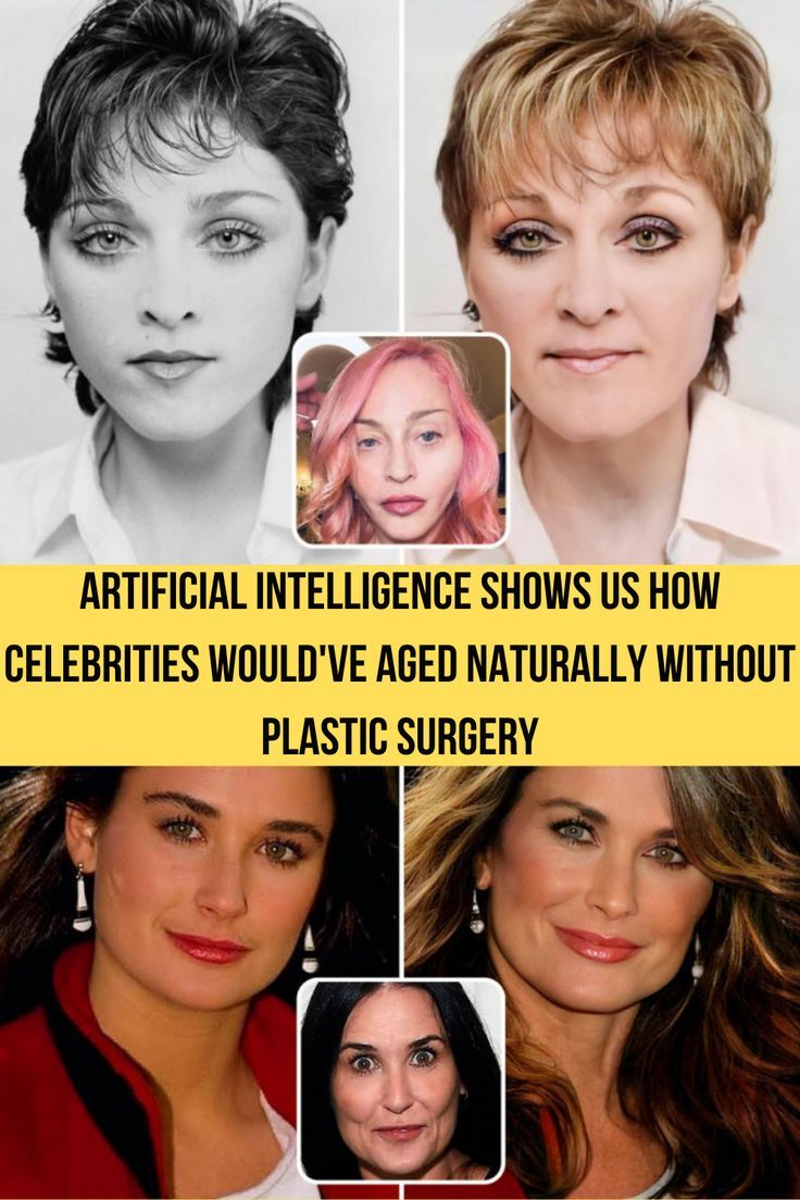 Artificial Intelligence Shows Us How Celebrities Would've Aged Naturally Without Plastic Surgery