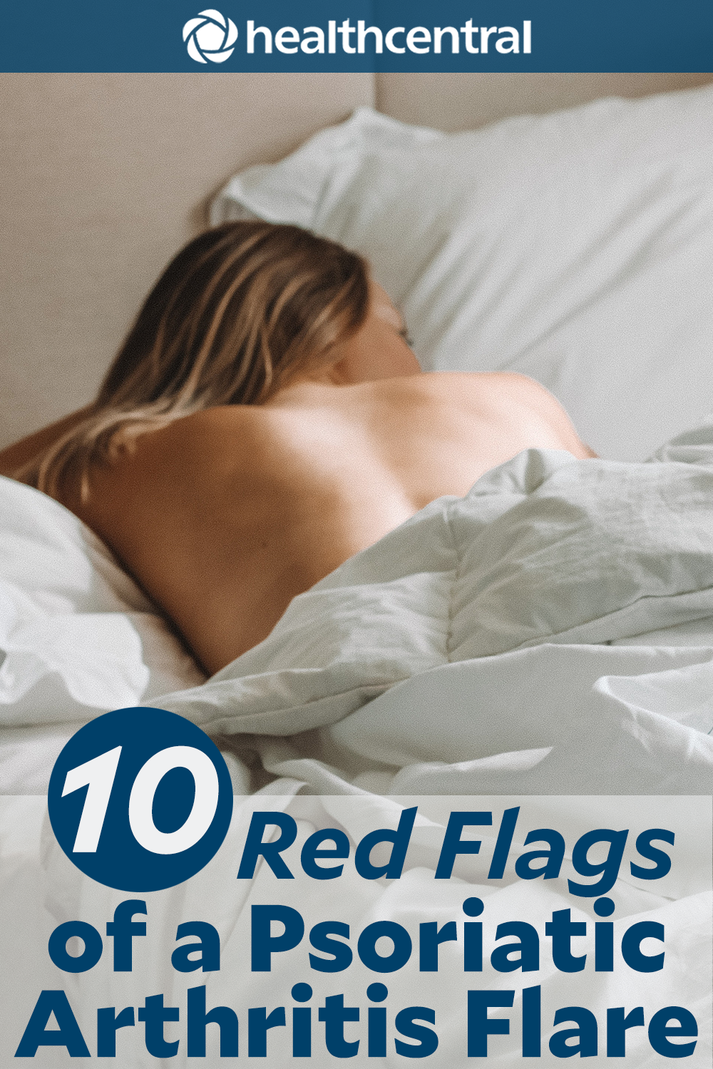 Red Flags of a Psoriatic Arthritis Flare