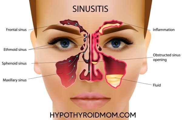 The Thyroid, Nose And Sinuses