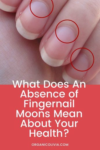 What Does An Absence of Fingernail Moons Mean About Your Health? - Organic Olivia