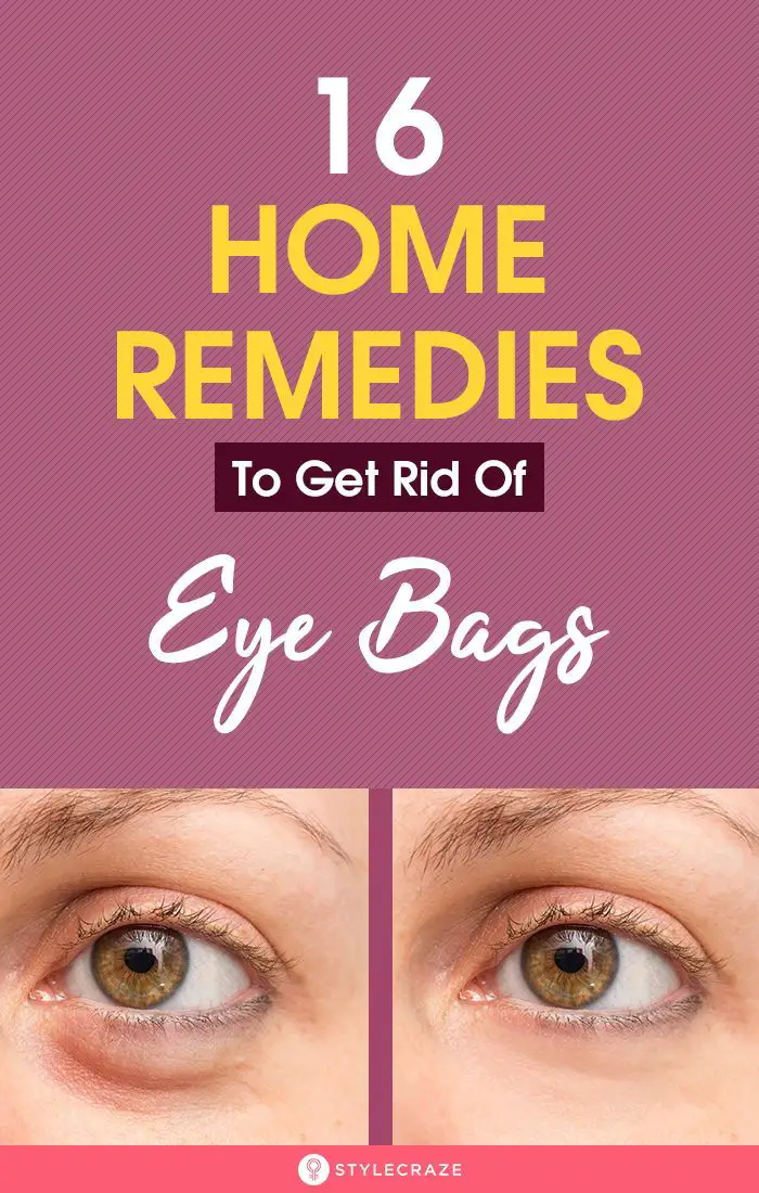 16 Home Remedies To Get Rid Of Eye Bags
