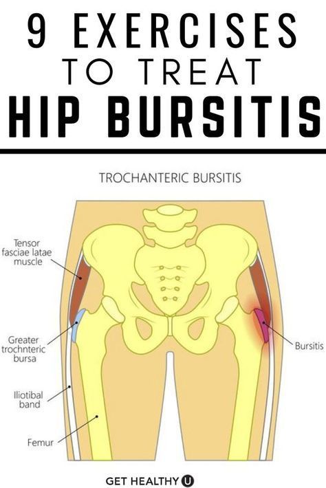 9 Best Exercises For Hip Bursitis | Best exercise for hips, Bursitis hip, Hip workout