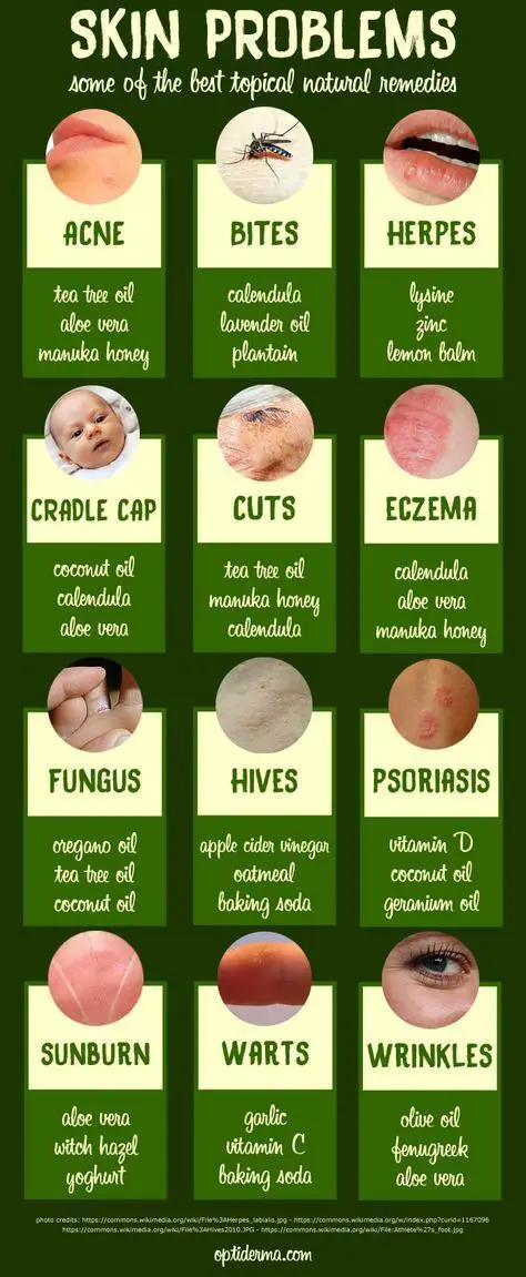Natural Remedies for Skin Issues - Why use Them for Skin?