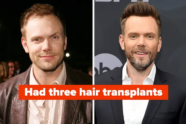 there’s-a-lot-of-fake-hair-in-hollywood,-so-here-are-12-male-celebs-who-have-been-candid-about-using-wigs-and-surgery-to-get-their-locks