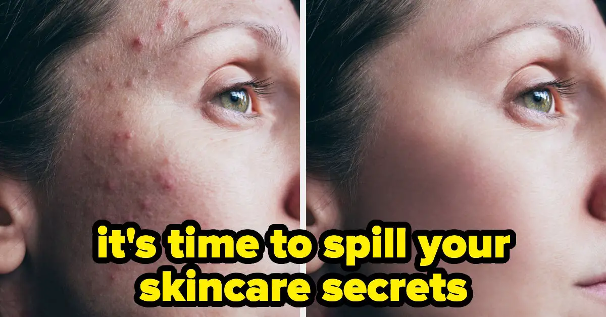 Sharing Skincare Advice