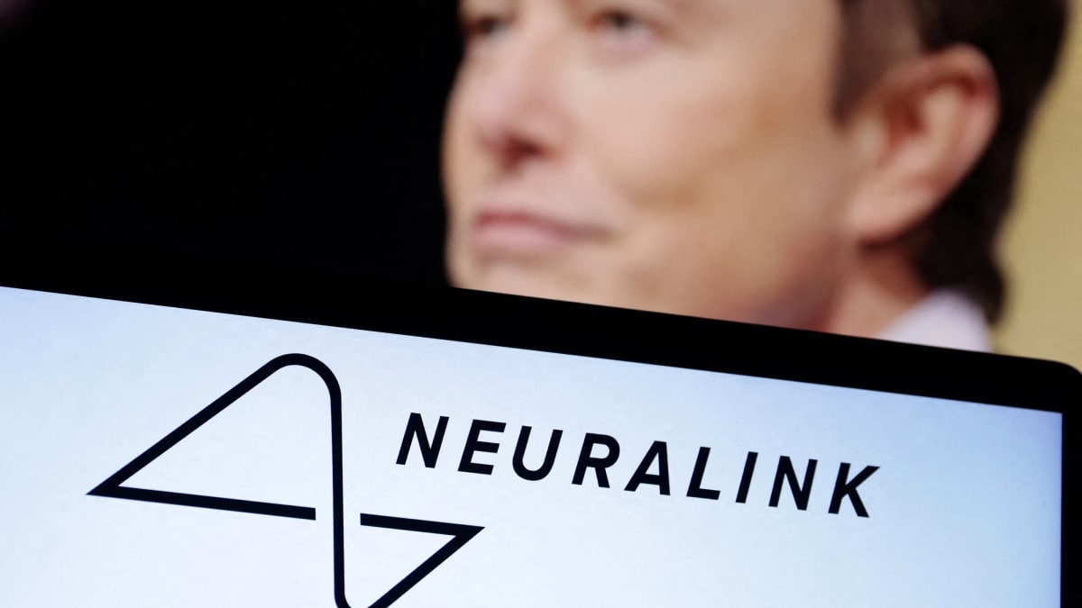Would You Let Elon Musk Implant a Device in Your Brain?