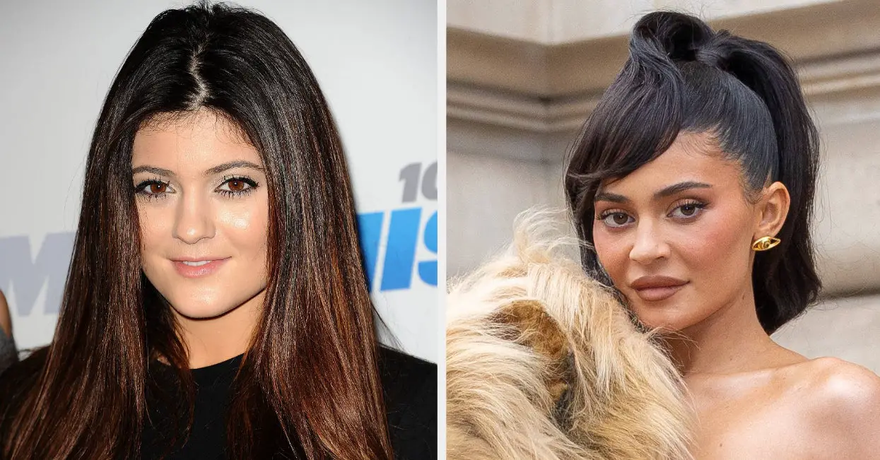 Kylie Jenner Talks Plastic Surgery Regret