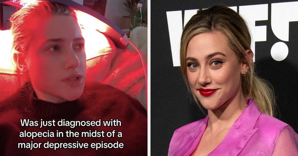 Lili Reinhart Opens Up About Alopecia in Viral TikTok