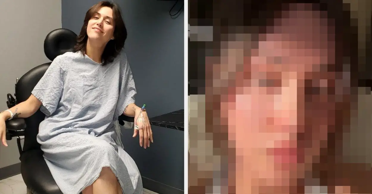 3 Months After Undergoing Facial Feminization Surgery, "Drag Race" Star Adore Delano Has Posted Her Results