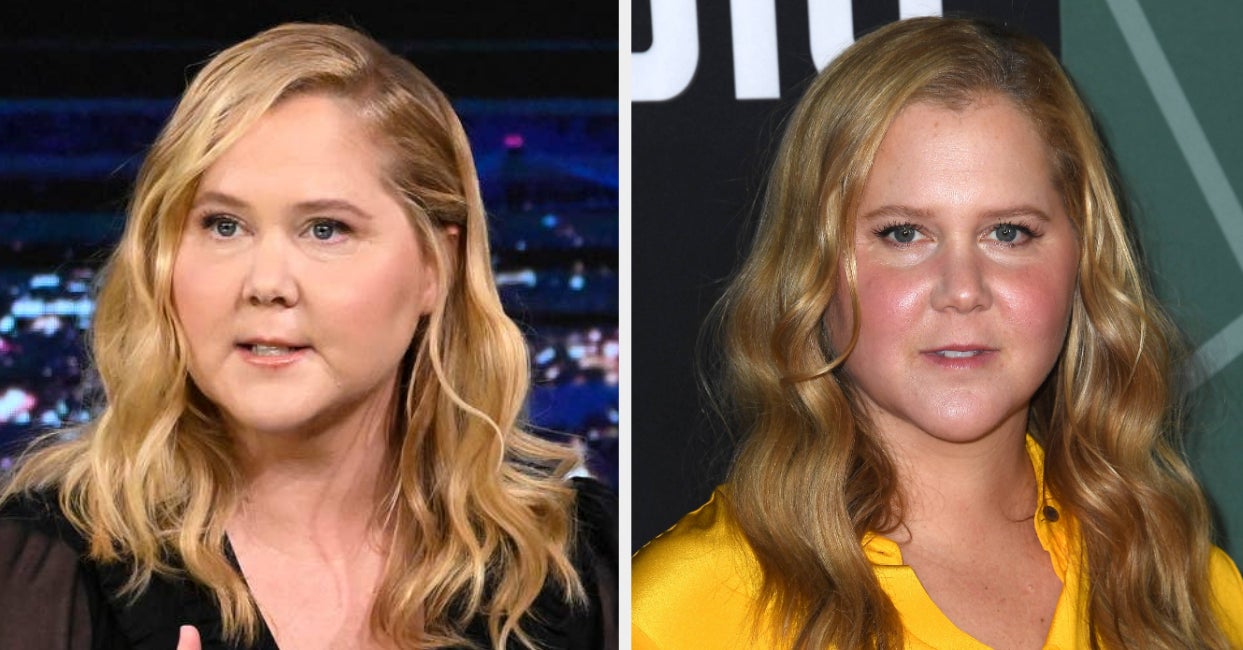 Amy Schumer Shared A Heath Update Amid Heaps Of Speculation Around Her “Puffier” Face, And It’s A Reminder Not To Comment On People’s Bodies