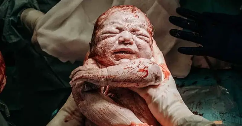 27 Stunning Birth Photos That Were Just Named The Best Of 2023