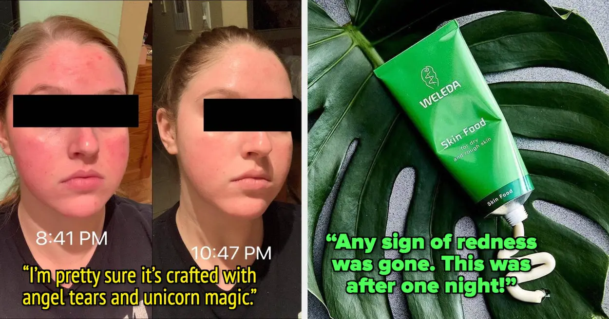 21 Skincare Products From Amazon That Reviewers Swear Help With Redness