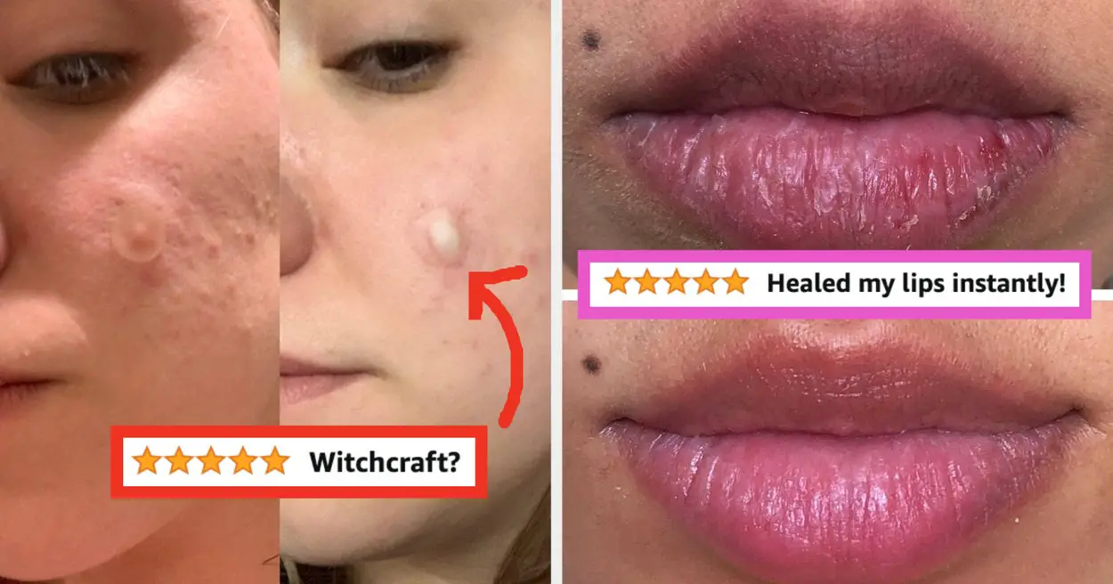 28 Products If You Want To Start A Skincare Routine And Don’t Know Where To Begin