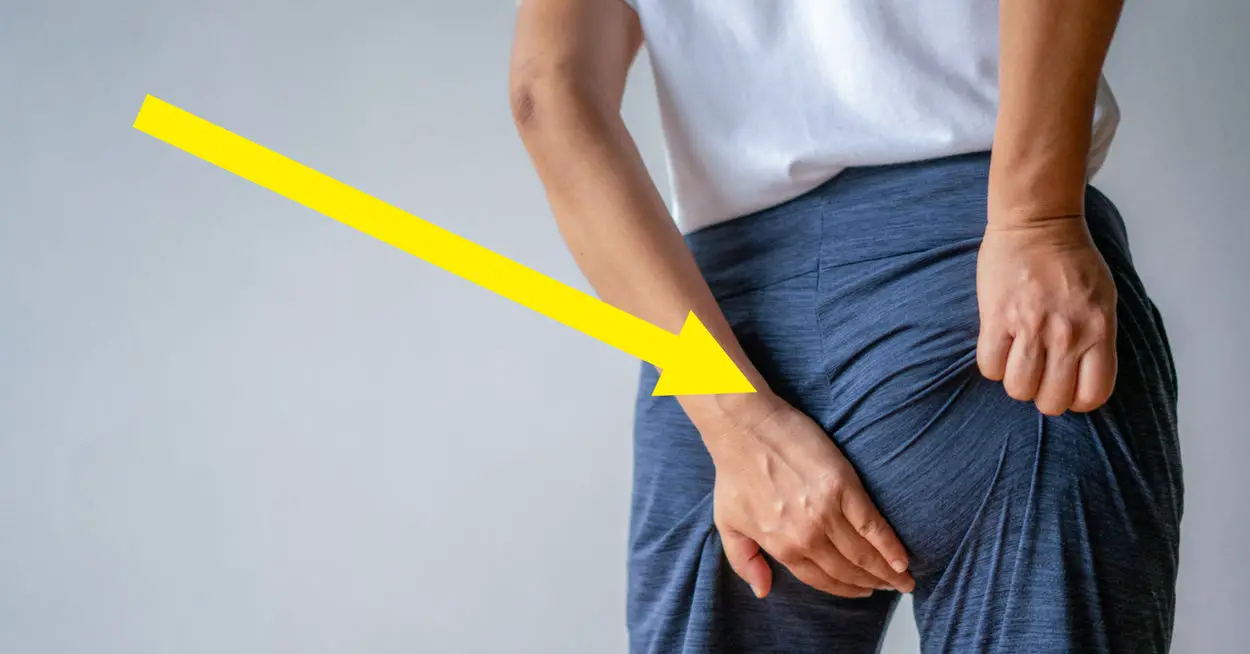 "People's Butts Are Literally Falling Asleep" — Experts Are Sharing How To Tell If You Suffer From Dead Butt Syndrome
