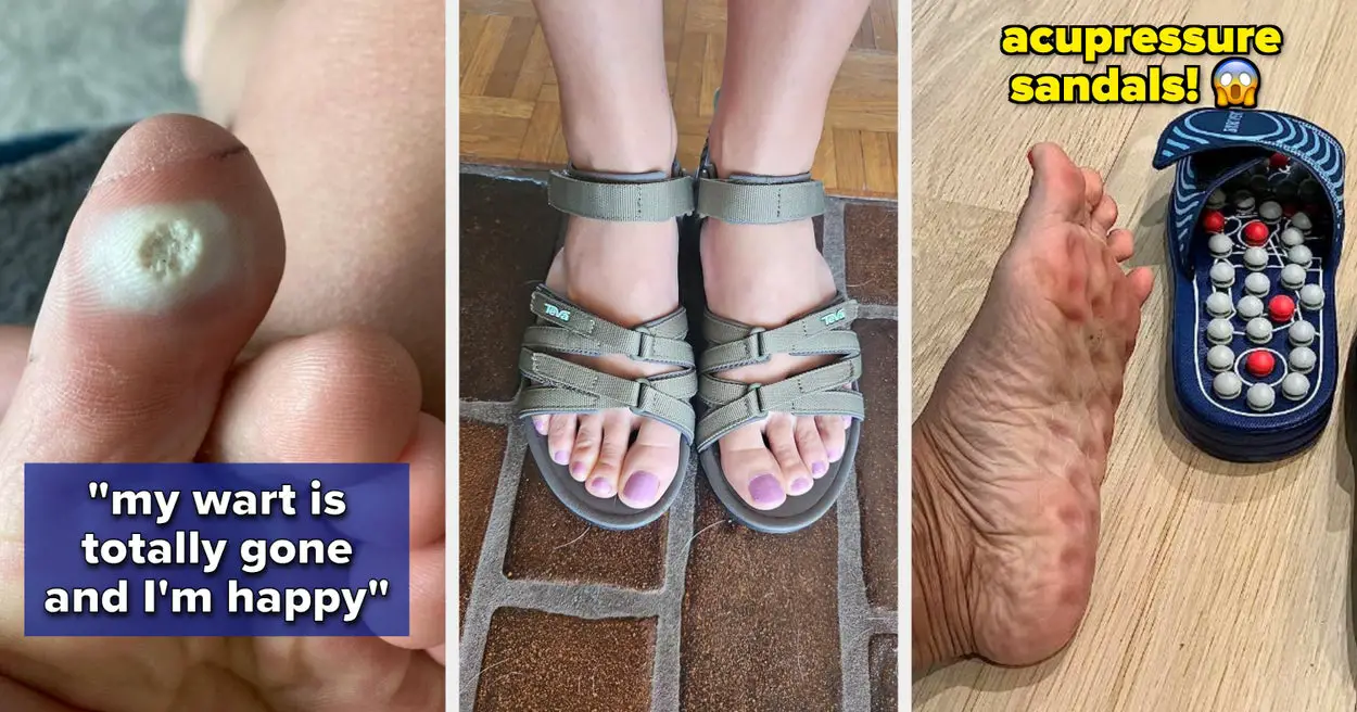 38 Products Made For Feet Even If The Pics Disgust You