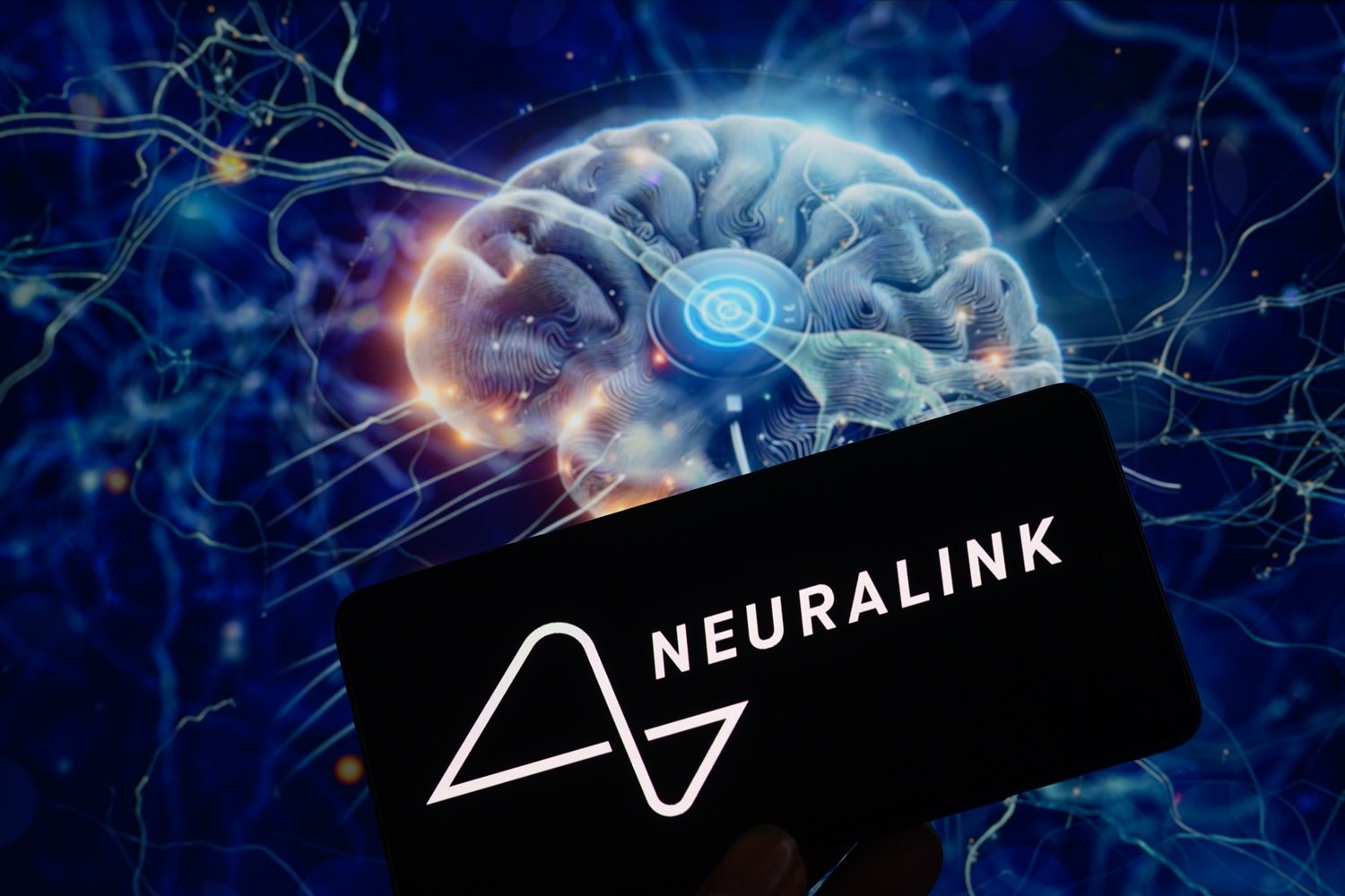 neuralink’s-second-patient-is-already-playing-counter-strike-2