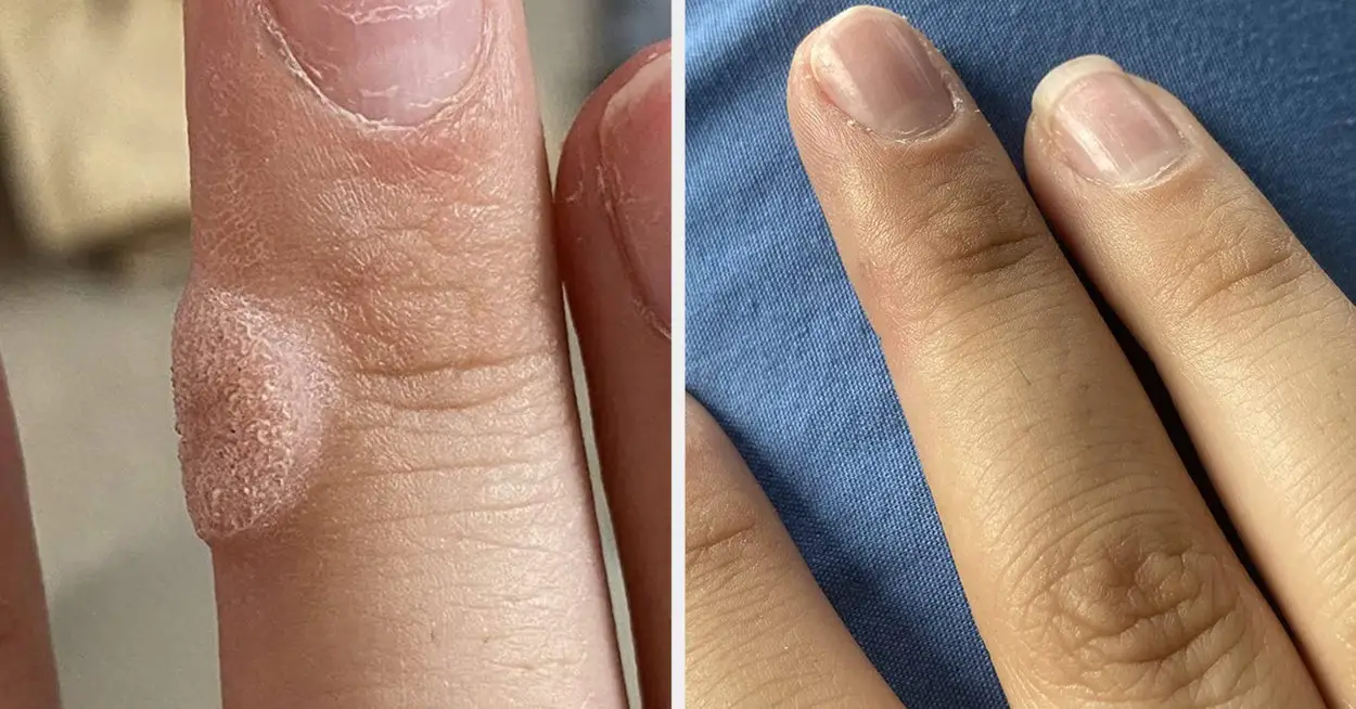 29 Beauty Products With Amazing Before And After Pics