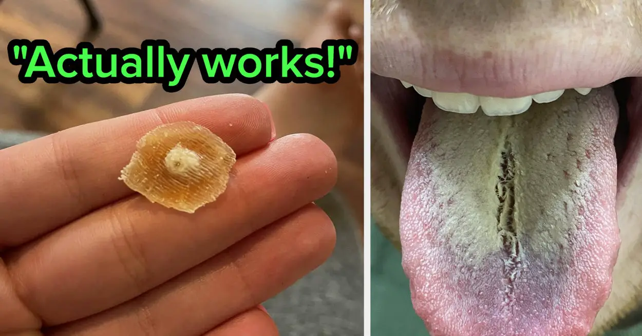 36 Products With Disgusting Before And After Photos